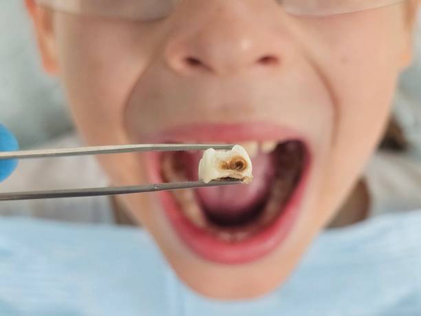 Best Emergency Pediatric Dental Care in Pomeroy, OH